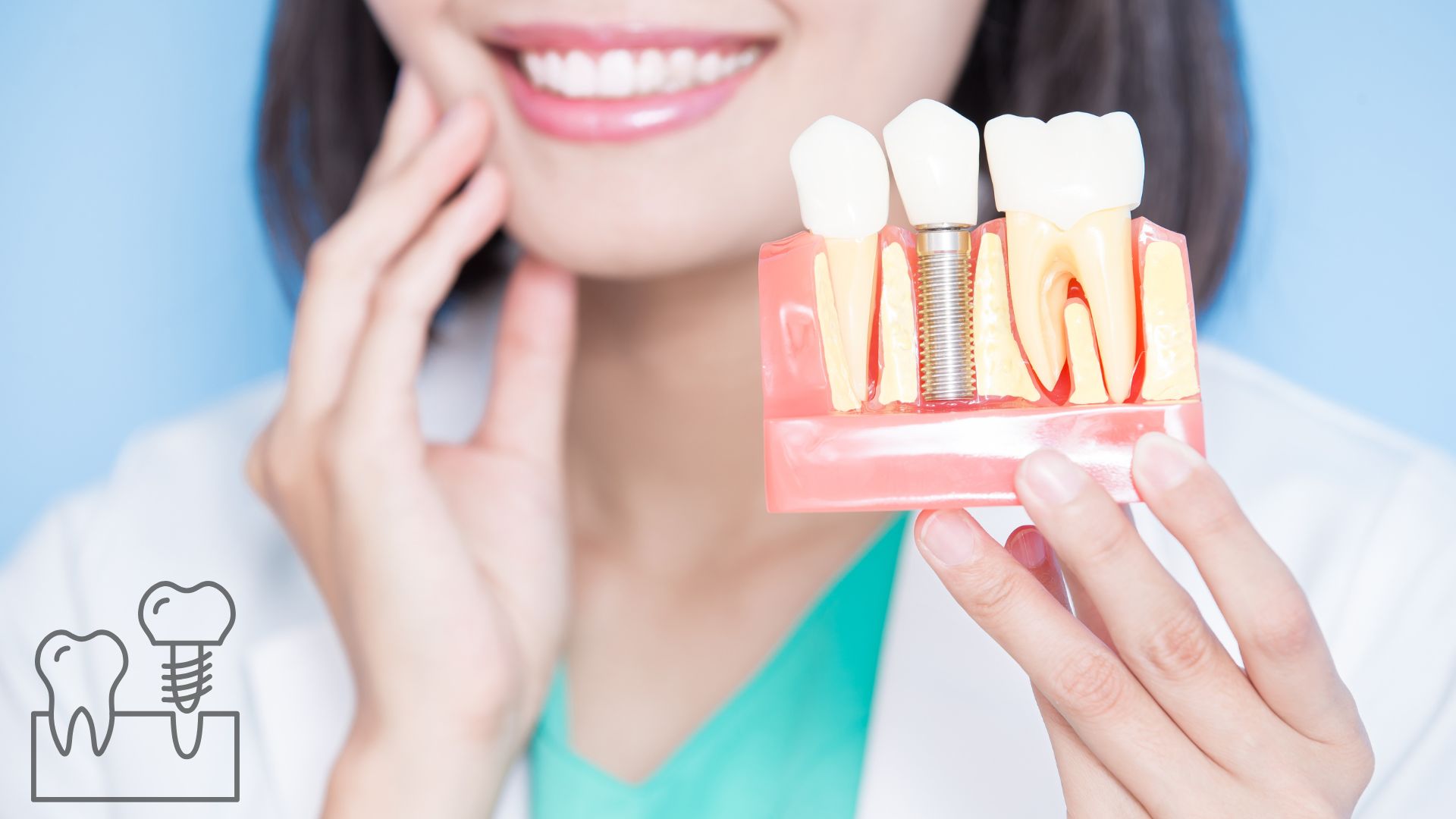 Dental Implants in Atlanta: Your Complete Guide to Candidacy, Benefits, and Procedure