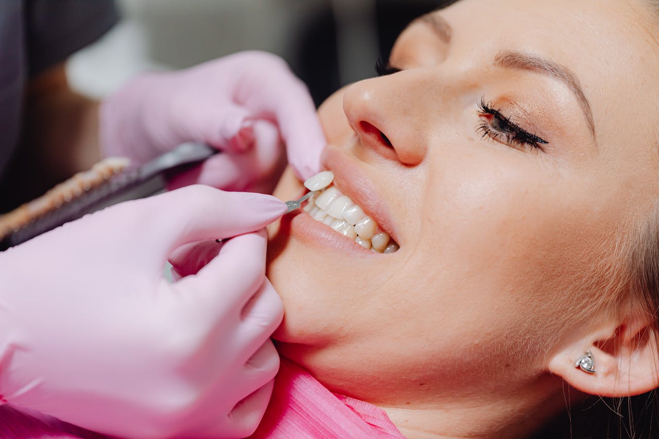 A close-up of a woman receiving dental veneers, showcasing detail and precision.